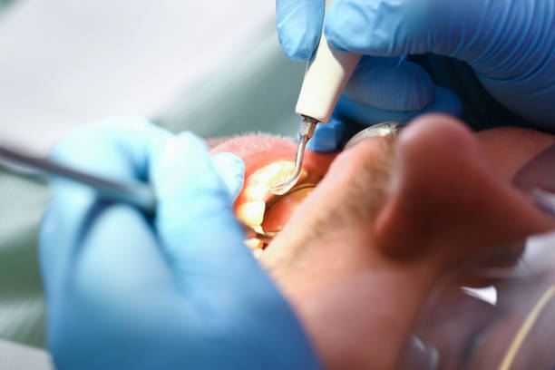 Best Cosmetic Emergency Dentistry in Stockton, KS