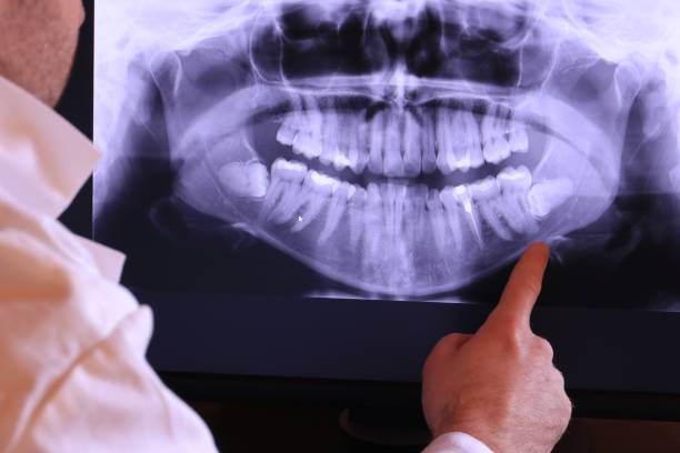 Best Emergency Treatment for Dental Infections or Abscesses in Stockton, KS