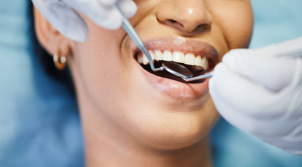 Best Urgent Care for Lost Fillings or Crowns in Stockton, KS