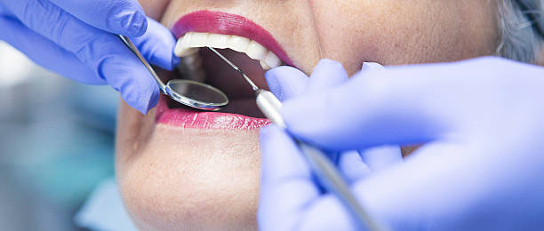 Best Emergency Denture Repair in Stockton, KS